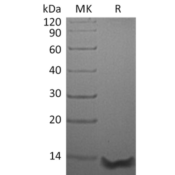 Human ACVR1C Protein, hFc Tag