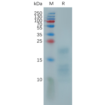 Human CD14(20-352) Protein, His Tag