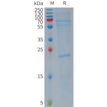 Human GPR56 Protein, His Tag