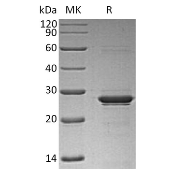 Human CXADR Protein, hFc Tag