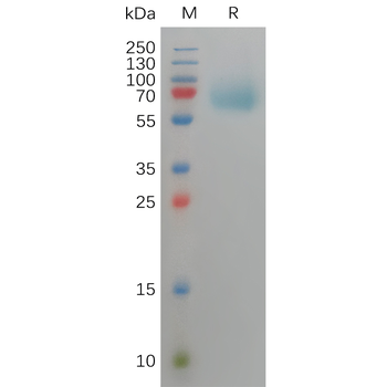 Human SIGLEC5 Protein, His Tag