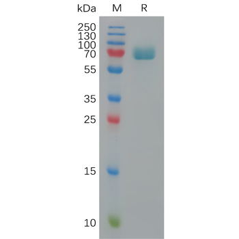 Human PLXDC2 Protein, His Tag