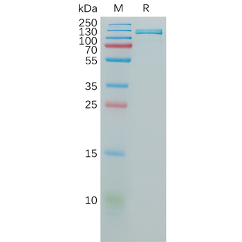 Human TFF1 Protein, hFc Tag