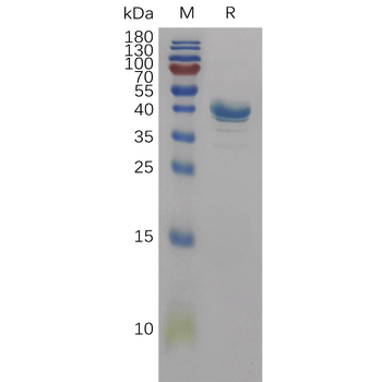Human CD55 Protein, His Tag
