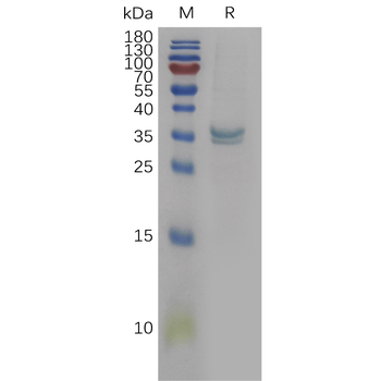 Human LDLR Protein, His Tag