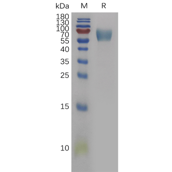 Human SERPINF2 Protein, His Tag