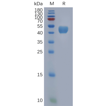 Human VSTM5 Protein, hFc Tag