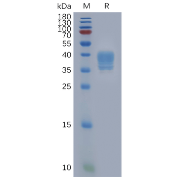 Human LRP6 Protein, His Tag