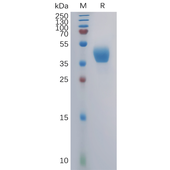 Human BTK Protein, Flag Tag