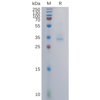 Human CLDN4(145-157) Protein, hFc Tag