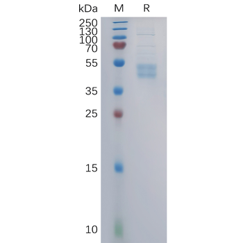 Human CLDN3(144-156) Protein, hFc Tag