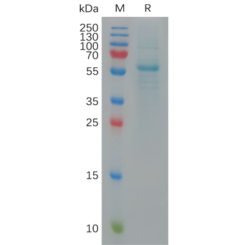 Human POSTN Protein, His Tag