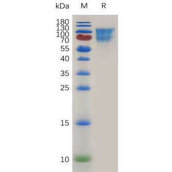 Human VPS4 Protein, His Tag