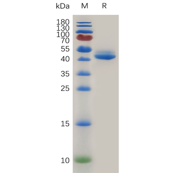Human CDH10 Protein, His Tag