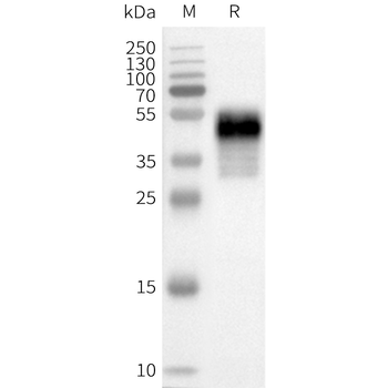 Human NPY1R full length protein-synthetic nanodisc