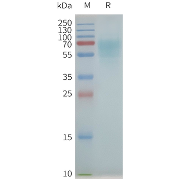 Human NK1R full length protein-synthetic nanodisc