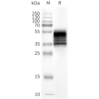Human KISSR full length protein-synthetic nanodisc