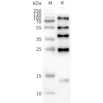 Human ILDR2 full length protein-synthetic nanodisc