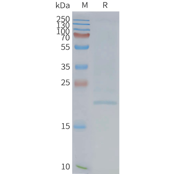 Human EMP2 full length protein-synthetic nanodisc