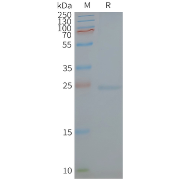 Human CAV1 full length protein-synthetic nanodisc
