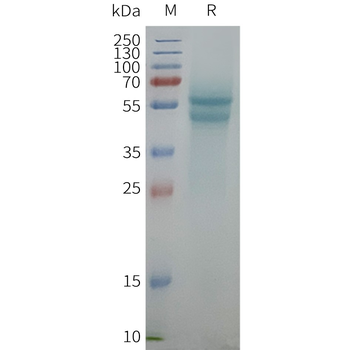 Human ADRB1 full length protein-synthetic nanodisc