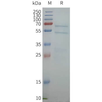 Human ABCG1 full length protein-synthetic nanodisc