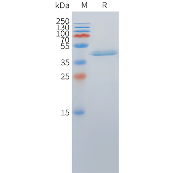 Cynomolgus CD30 Protein, His Tag
