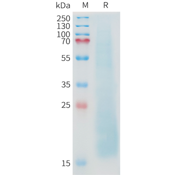 Cynomolgus CA9 Protein, His Tag