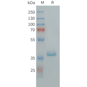 Cynomolgus ALPP Protein, His Tag