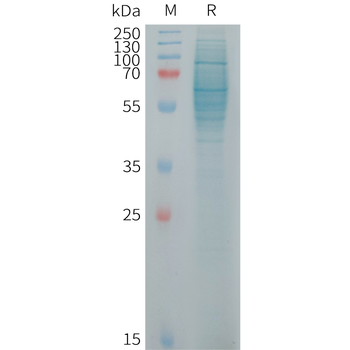 Human ADGRD1 Protein, His Tag