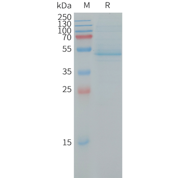 Human MET Protein, His Tag