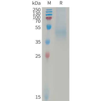 Human ADGRE5 Protein, His Tag