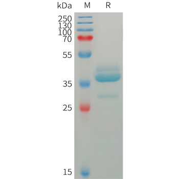 Human CGRPR Protein, mFc Tag