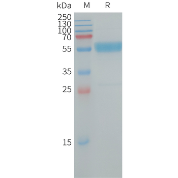 Human MET Protein, hFc Tag