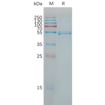 Human IL25 Protein, hFc Tag
