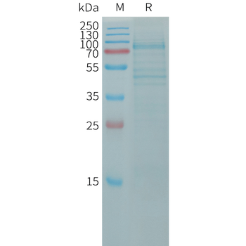 Human C5 Protein, His Tag