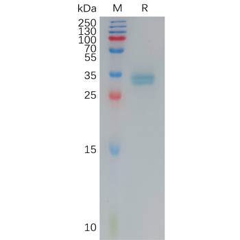 Human MSR1 Protein, His Tag