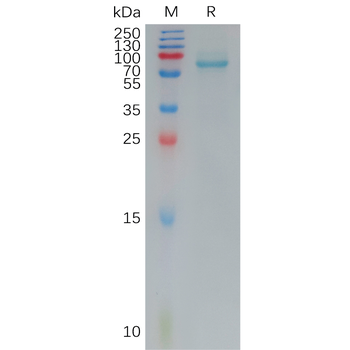 Human KIR3DL3 Protein, His Tag