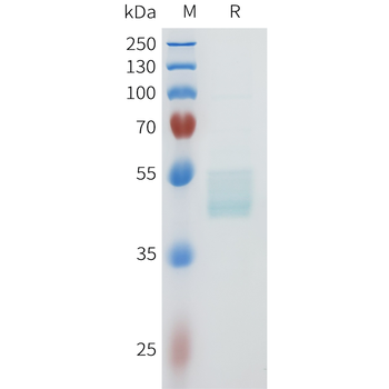 Mouse CDH17 Protein, His Tag