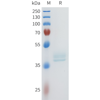 Mouse ROR2 Protein, His Tag