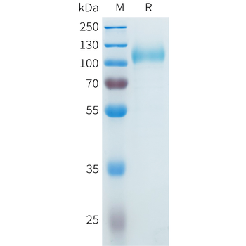 Mouse AXL Protein, His Tag