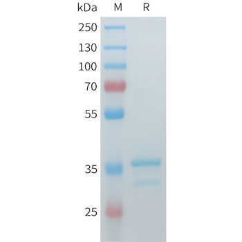 Mouse HistoneH1.2 Protein, hFc Tag