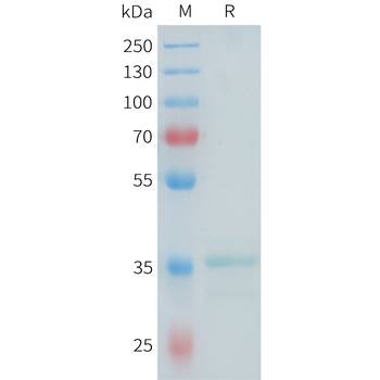 Mouse TNFRSF1B Protein, His Tag