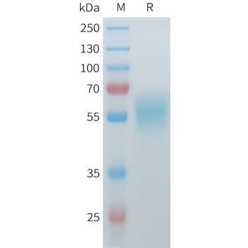 Mouse EPHA2 Protein, His Tag