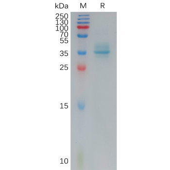 Human IL13RA2 Protein, hFc Tag