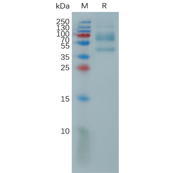 Human EGFRVIII Protein, His Tag
