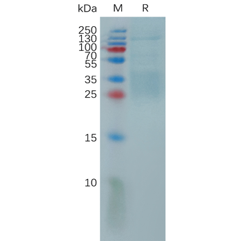 Human ENPP2 Protein, His Tag