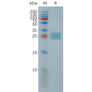 Human CSPG5 Protein, His Tag