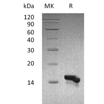Human CFD Protein, hFc Tag