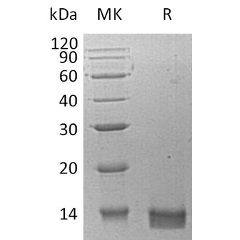 Human IL4 Protein, mFc Tag